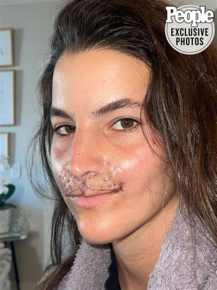 Brooklinn Khoury Recalls Being 'Scared' of How She Looked After Dog Attack
