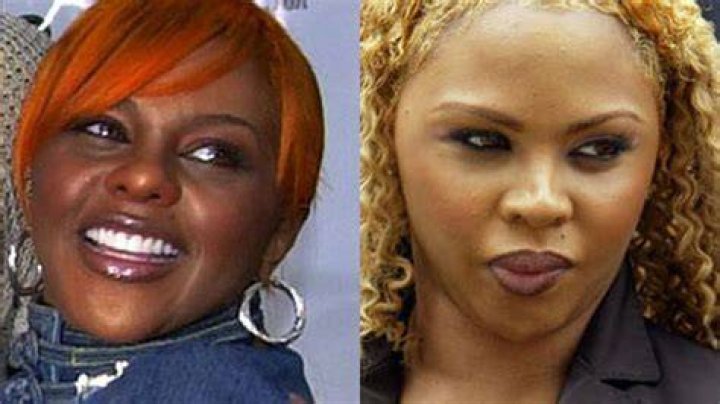 Celebrity plastic surgery disasters Fox News