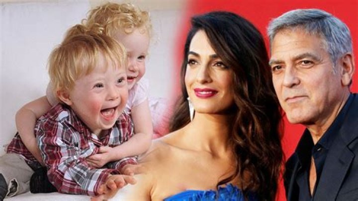 Clooney Twins Down Syndrome Ella And Alexander Health