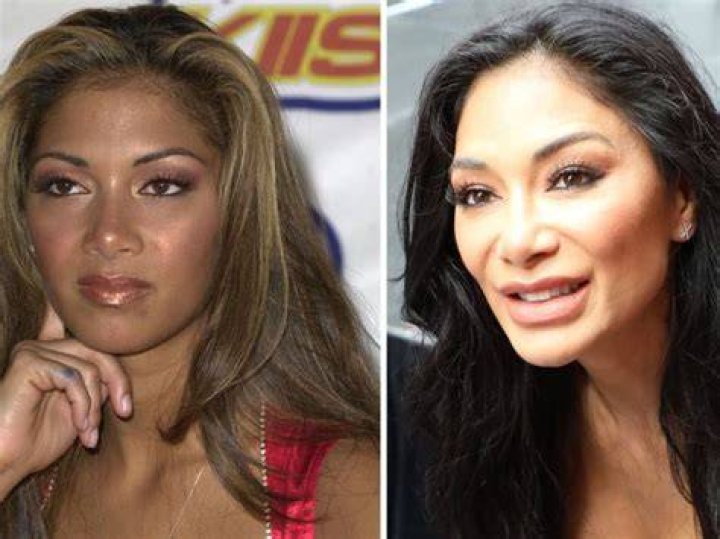 Did Nicole Scherzinger Just Have Plastic Surgery? DemotiX