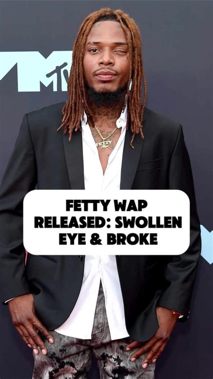 Fetty Wap's Left Eye: The Story Behind The Iconic Look
