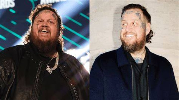 Jelly Roll Weight Loss Photos Before And After