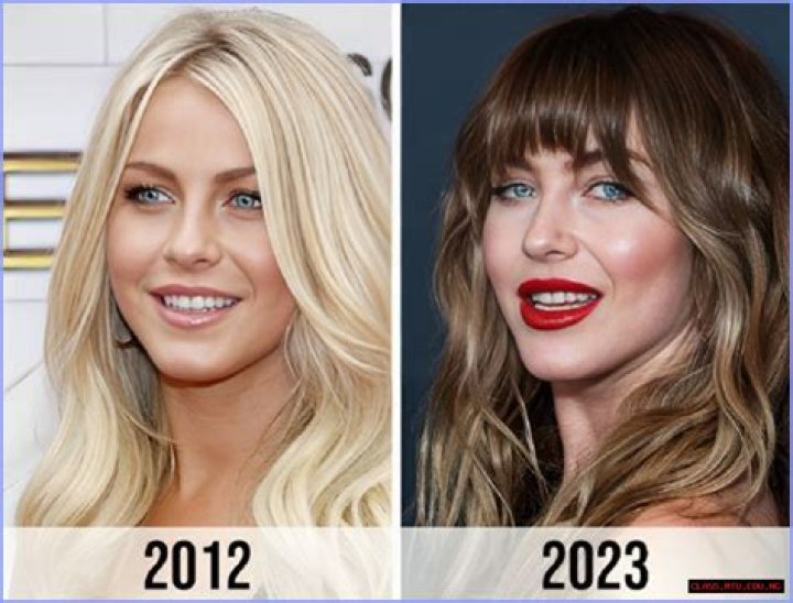 Julianne Hough: The Journey Of Transformation Through Plastic Surgery