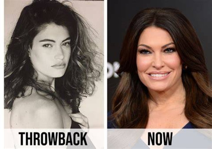 Kimberly Guilfoyle plastic surgery (27) Celebrity plastic surgery online