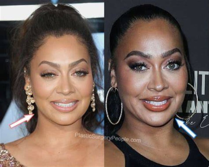 Lala Anthony, BEFORE and AFTER 2022