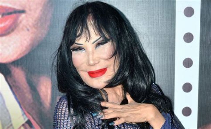 Lyn May y su rostro antes de las cirug&iacute;as El Diario NY