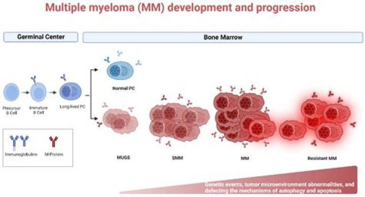 Myeloma How To GREATLY Improve The High Risk Myeloma Survival Rate