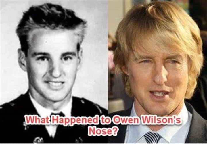 Owen Wilson Broke His Nose 'Roughhousing' at Least Twice