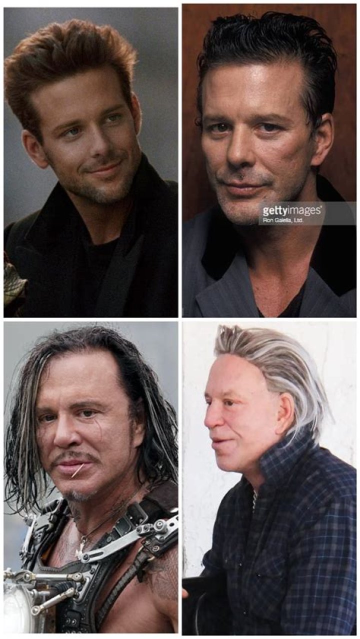 The Evolution Of Mickey Rourke Before And After Plastic Surgery 