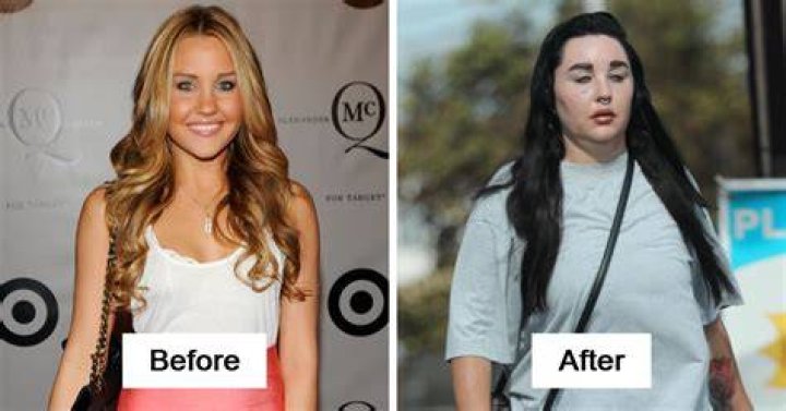 Then And Now Celebrities Who Lost Their Youth And Haven&rsquo;t Improved