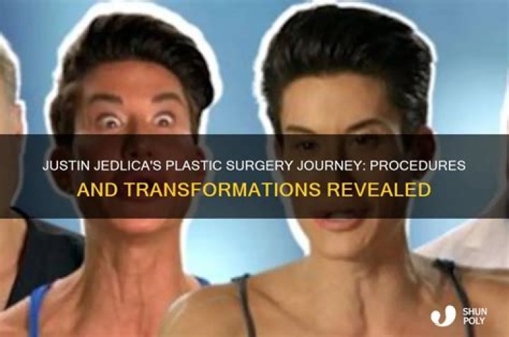 Transformations And Revelations: Justin Jedlica Before Plastic Surgery