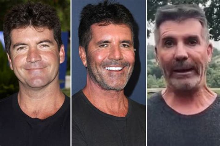 Unraveling The Truth: Did Simon Cowell Have Cancer?
