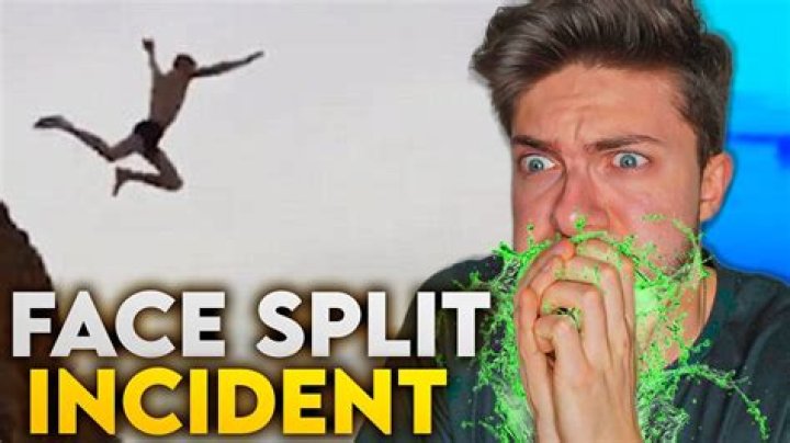 When A Guy Splits Face: The Shocking Incident That Left Everyone Speechless